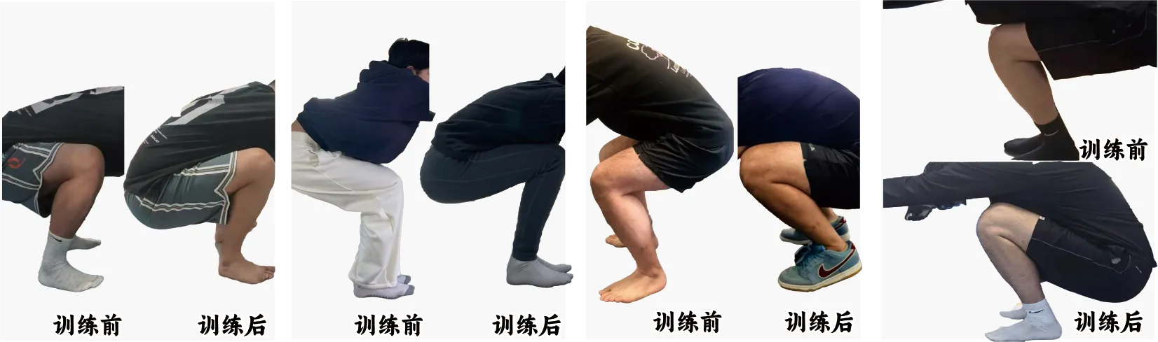下蹲不全矫正案例